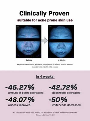 COSRX The Niacinamide 15 Serum – Ορός με νιασιναμίδη για καταπολέμηση της ακμής - 20 ml