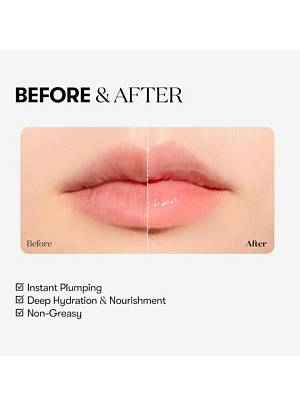 VT Reedle Shot Lip Plumper Expert- Gloss με μικροβελόνες και εφέ όγκου