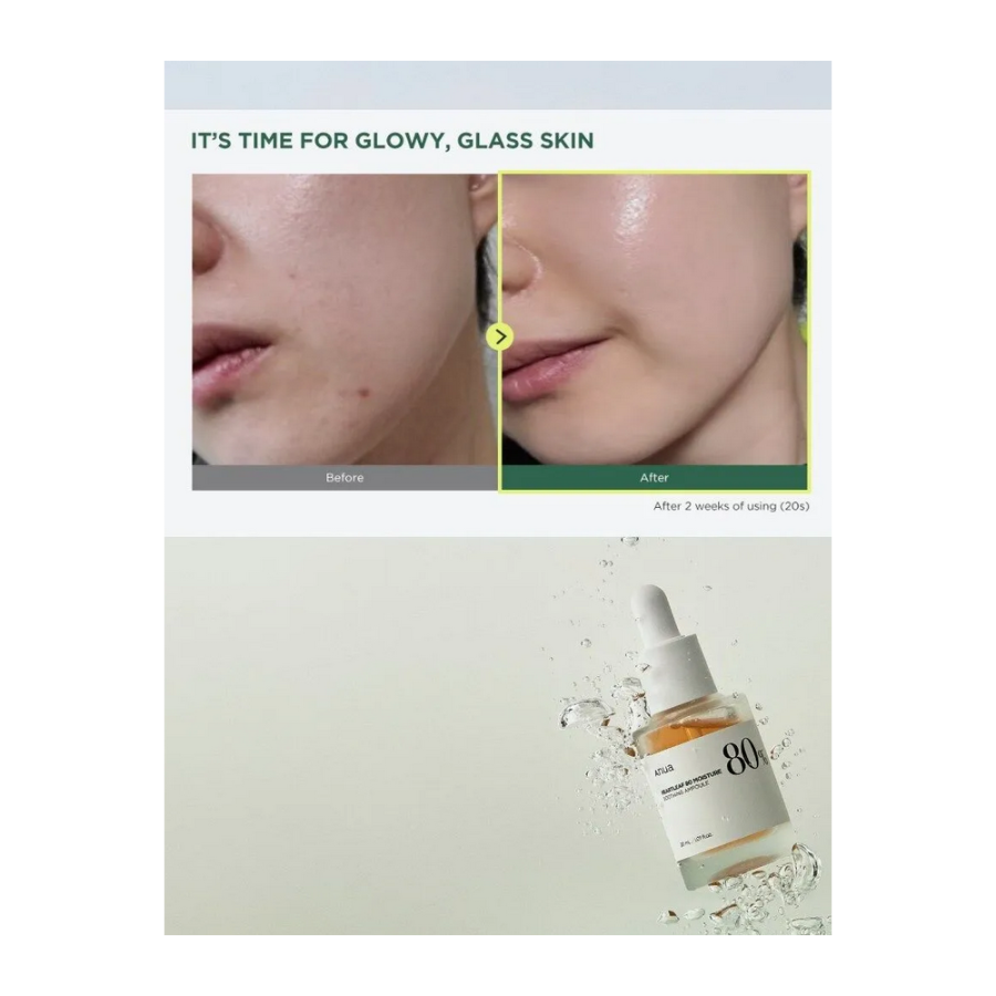 Anua Heartleaf 80% Soothing Ampoule 30ml – Ενυδατική καταπραϋντική αμπούλα για glass skin 30ml
