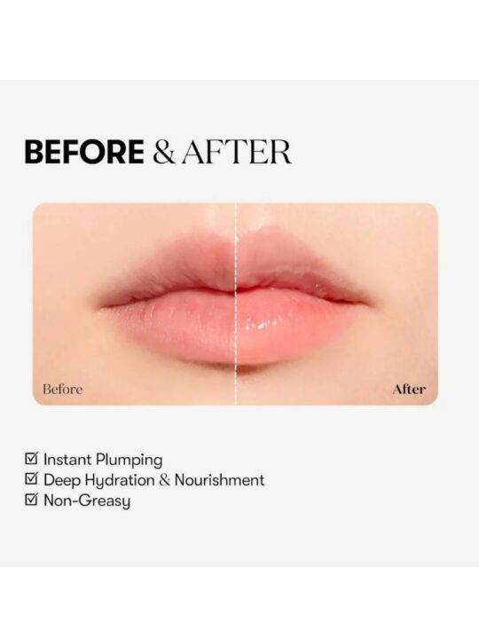 VT Reedle Shot Lip Plumper Expert- Gloss με μικροβελόνες και εφέ όγκου