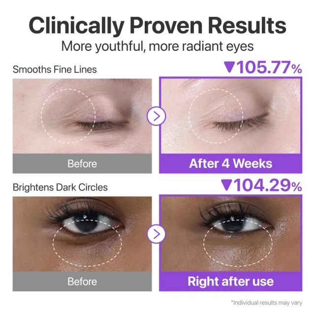 Numbuzin No.9 NAD Retinol Volumetox Eye Cream - Συσφιγκτική Κρέμα Ματιών με NAD+ & Ρετινόλη για Λεία, Ξεκούραστη Όψη 10ml